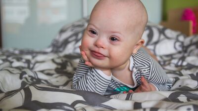 Down sendromu ile ilgili bunları biliyor musunuz?