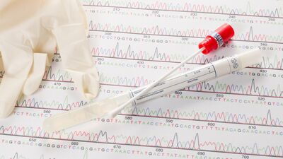 Smear testi ile ilgili bilmeniz gerekenler...