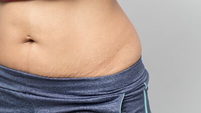 Doğumdan sonra nasıl forma gireceksiniz?