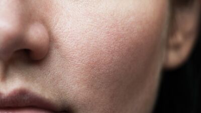 Cildi hızla yaşlandıran 10 alışkanlık