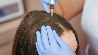Prp ile saç tedavisi nasıl yapılır?