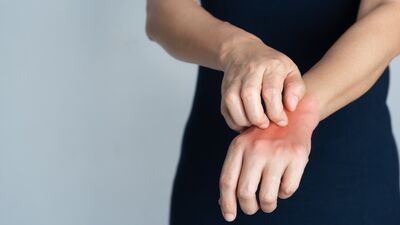 Uyuz hastalığına dikkat!