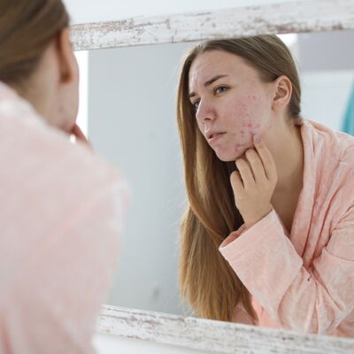 Akneye sebep olan alışkanlıklar