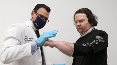 Dünyanın ilk başarılı yüz ve çift el nakli gerçekleştirildi