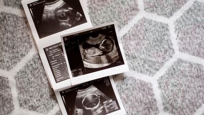 Bebekler anne karnında ağlar mı?