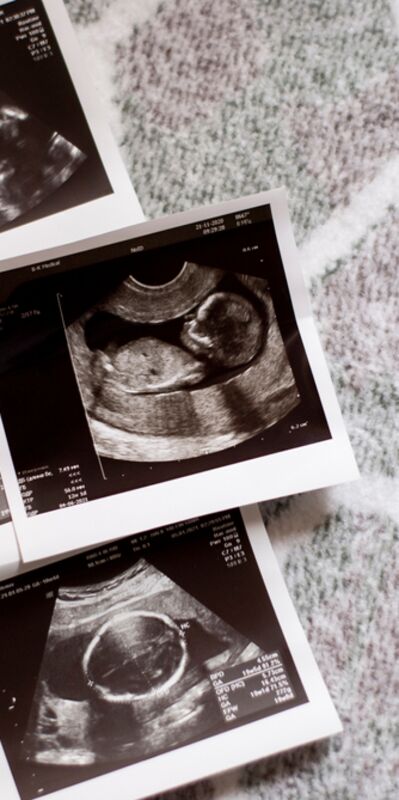 Ultrason terimleri ne anlama gelir?