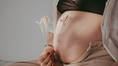 Hamilelikte cilt kuruluğu için çözümler