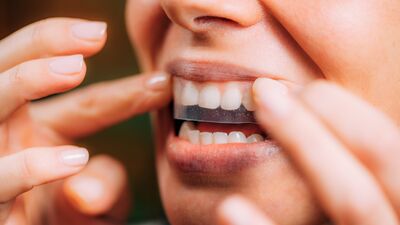 Diş beyazlatma bandı zararlı mı?