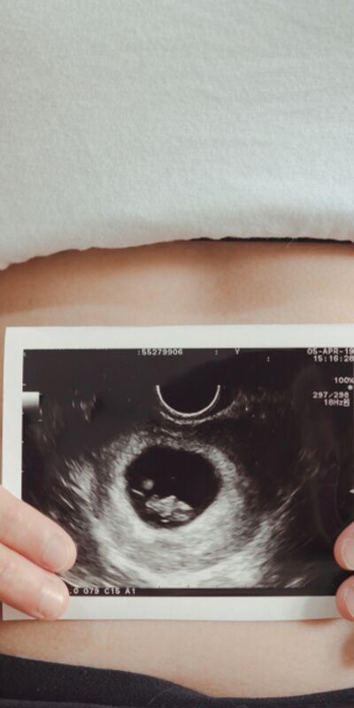 Dilay'ın gebelik günlüğü: 6. hafta