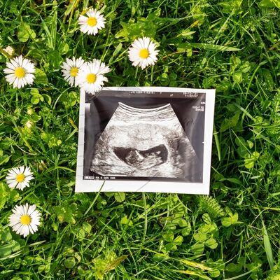 Dilay&#039;ın gebelik günlüğü: 8. hafta