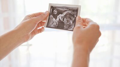 Dilay&#039;ın gebelik günlüğü: 11. hafta