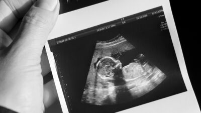 Dilay'ın gebelik günlüğü: 13. hafta