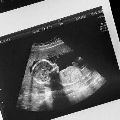 Dilay&#039;ın gebelik günlüğü: 13. hafta