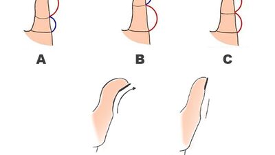 Başparmağınızın şekli kişiliğinizi ele veriyor!