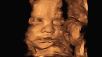 Dilay&#039;ın gebelik günlüğü: 21. hafta