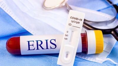 Eris varyantı Türkiye'de!