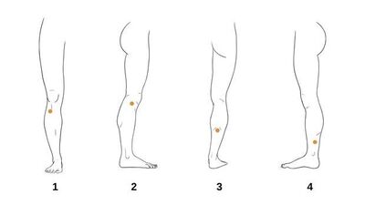 Huzursuz bacak sendromu için akupunktur noktaları