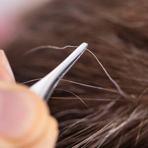 Beyaz saçlarınızı koparırsanız ne olur?