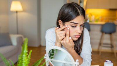 Sivilce sıkmanın zararları