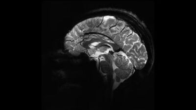 İnsan beyninin en net görüntüsü yayınlandı