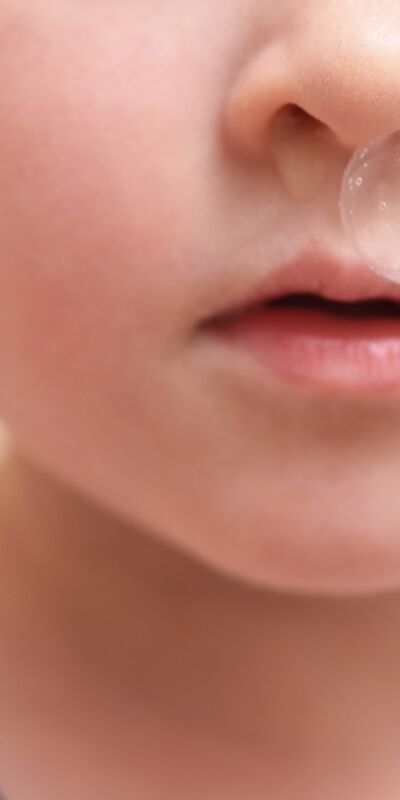 Sümük rengi neyi ifade eder?