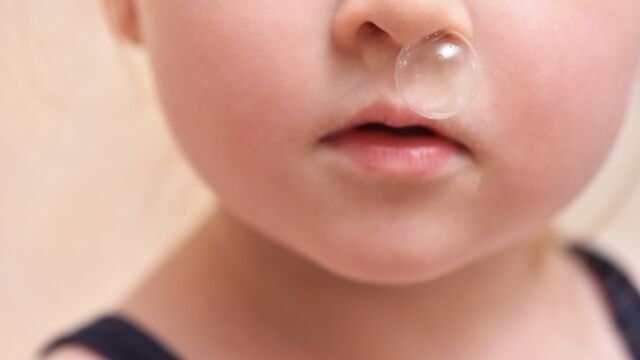 Sümük rengi neyi ifade eder?