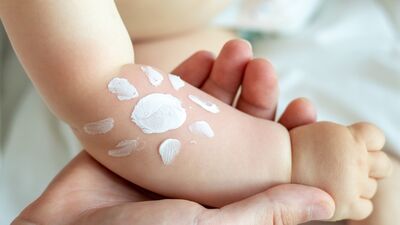 Bebek ve çocuklarda güneş yanığı