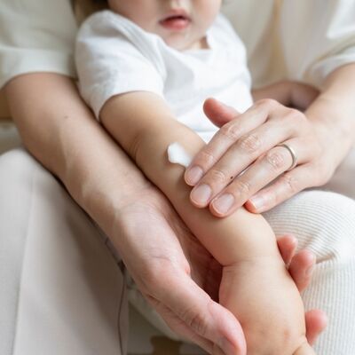 Çocuklarda losyonlara dikkat!