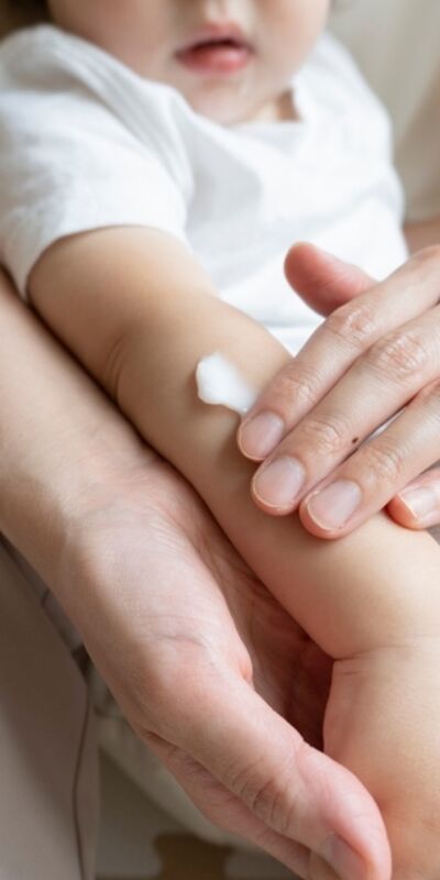 Çocuklarda losyonlara dikkat!