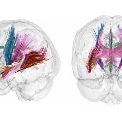Hamilelik annenin beynini değiştiriyor