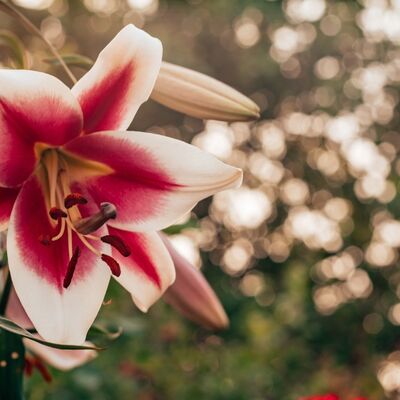 Vajinal doğum sonrası dikiş bakımı