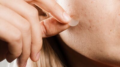 Sivilce bantları işe yarıyor mu?