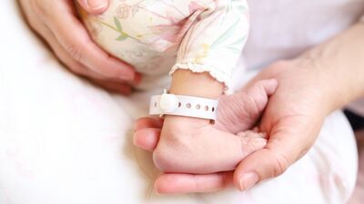 Yenidoğan sarılığı riski yaz aylarında artıyor