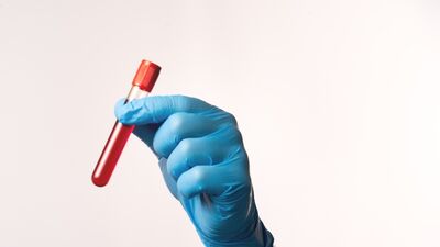 Yeni bir kan testi, kanseri tarama öncesi belirliyor