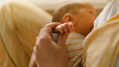  Mastit için evde uygulanabilecek doğal yöntemler