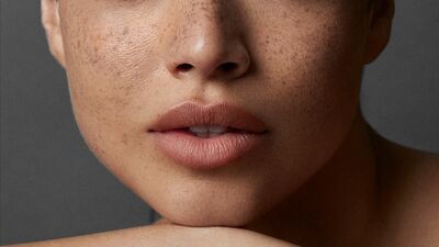 Cildiniz sinyal veriyor: Yaşlanmanın ilk belirtisi