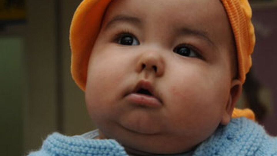 Bebeğe boş yere kemoterapi