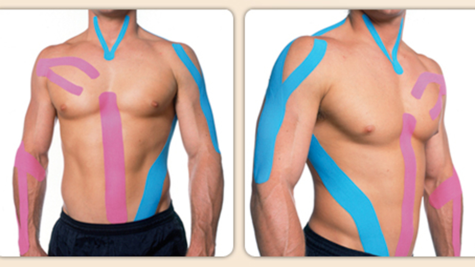 Estetik sonrası morluklara 'Kinesiotaping'