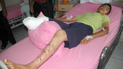 Hatay'da mayın patladı