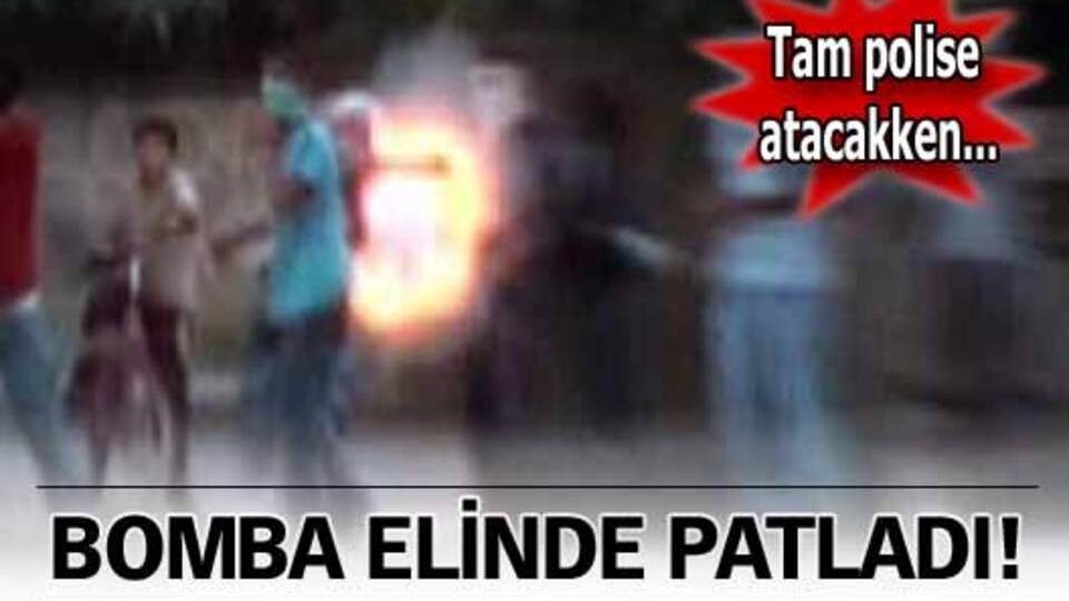 Bomba elinde patladı!