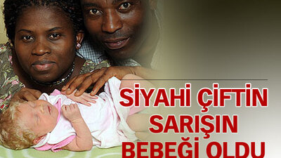 Siyahi çiftin sarışın bebeği oldu