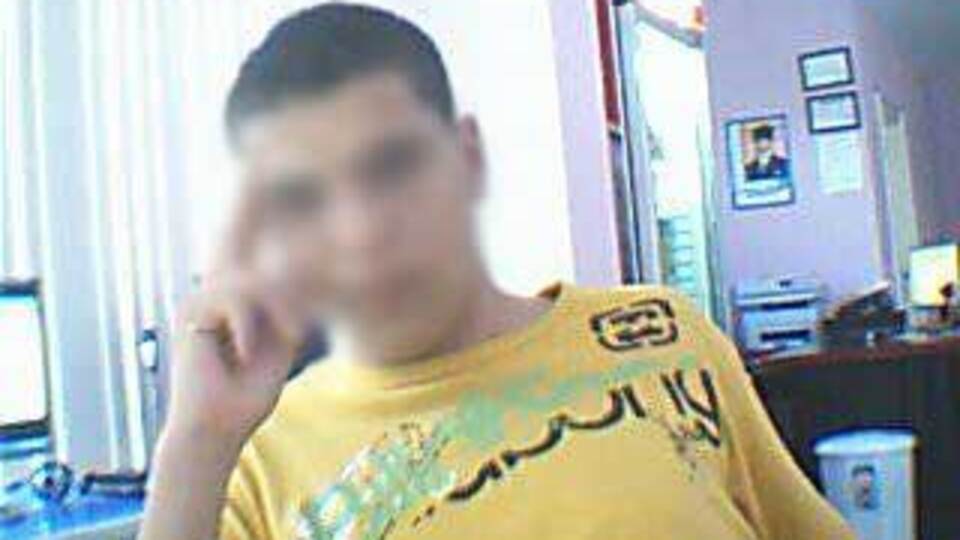 Bacağından alıp penis yaptılar!