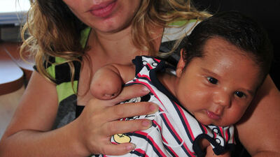 'Yarım kollu bebek doğumu'na suç duyurusu