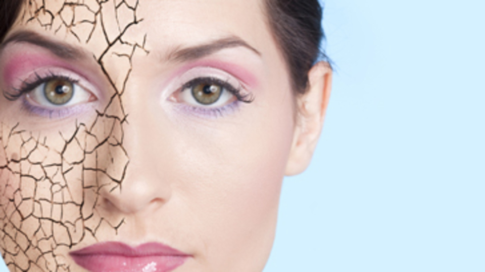 Cildiniz kuru mu?