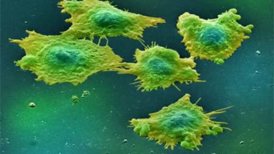 Hastalık avcısından 6 yeni hastalık