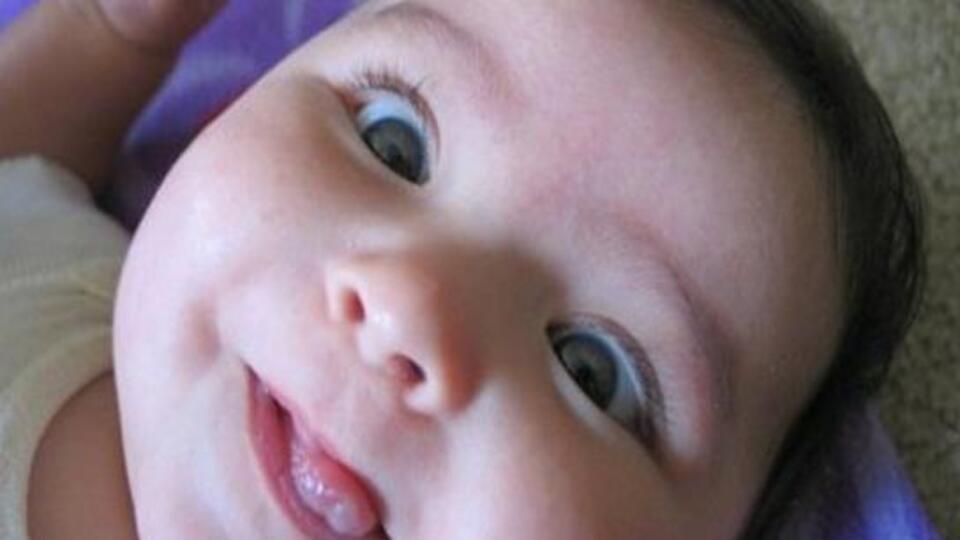 Şaşılık gerçek mi yalancı mı?