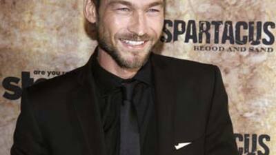 Spartacus'un yıldızı yeniden kanser oldu