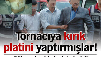 Kırık platinini tornacıya yaptırmışlar