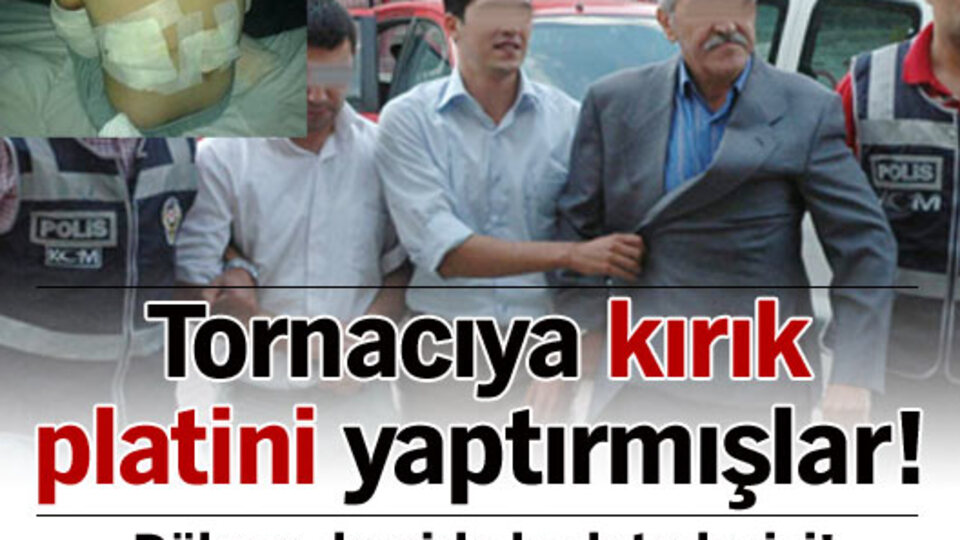 Kırık platinini tornacıya yaptırmışlar