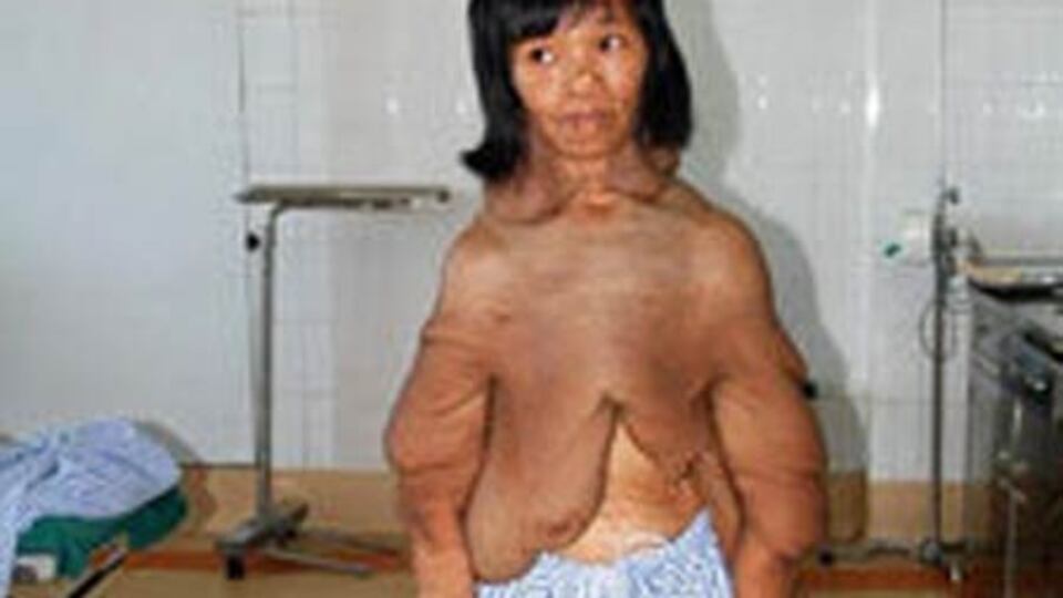 Böyle hastalık olmaz!